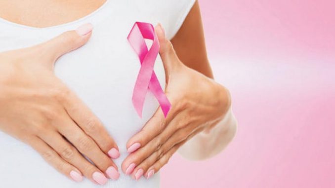 www.prensaciudadana.cl-cancer-de-mama-entre-las-principales-causas-de-fallecimiento-en-las-mujeres-chilenas-amiga-hazte-la-mamografia-es-por-ti-es-por-tu-vida-cancer-de-mama