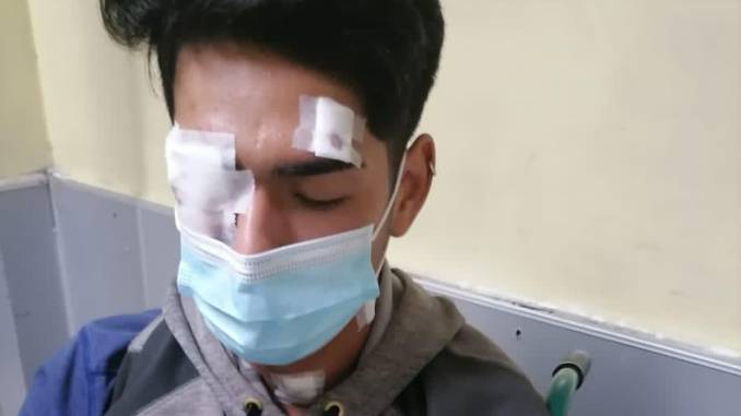 familia-y-amigos-del-joven-mapuche-herido-en-enfrentamiento-con-carabineros-se-reuniran-en-las-afueras-del-hospital-regional-para-darle-newen-enfrentamientos2-copy